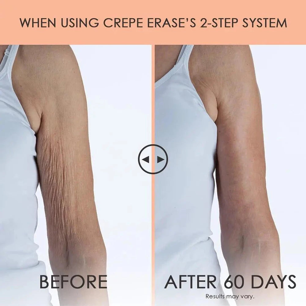 Crepe Erase 2-Step Advanced Body Care Treatment, Anti-Aging Skin Care for Body Neck - Hermony Essentials